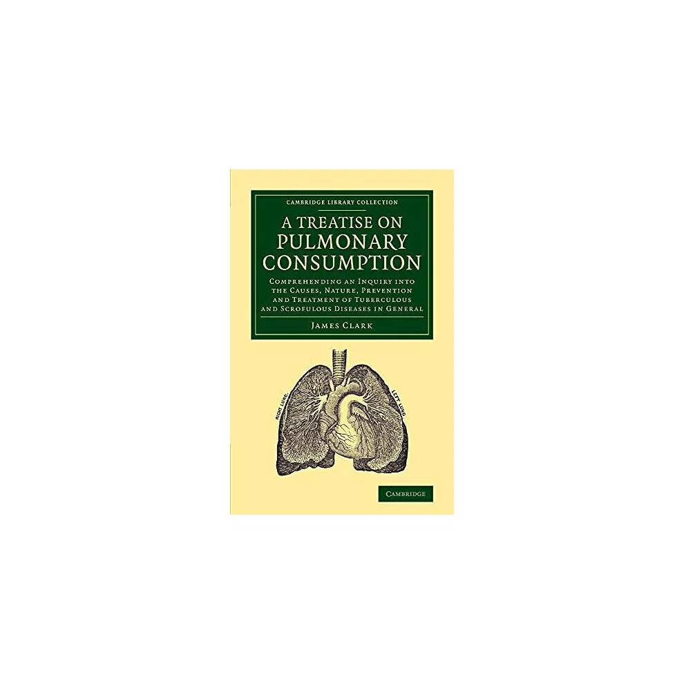 A Treatise on Pulmonary Consumption Comprehending an Inquiry Into the Paperback