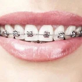 Atosa Salvia Ortho Dental Day